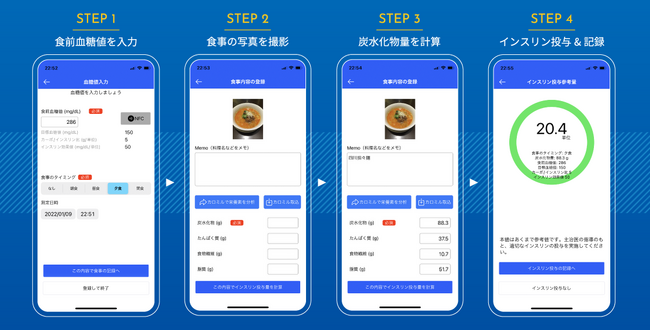 1型糖尿病患者向けインスリン投与量判定システムの特許取得