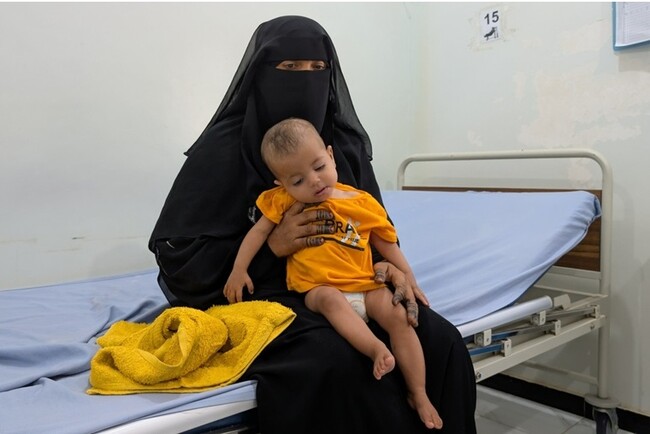 イエメン：子どもの栄養失調が極めて深刻なレベルに──援助の拡大が急務