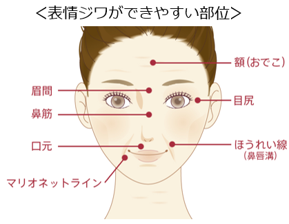 ＜4月8日はシワの日＞知らず“老け見え”しているかも？自分では気づきにくい“表情ジワ”にご注意