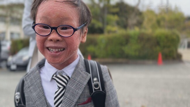 「ピエロと呼ばれた息子」を５年間取材し見えてきたこととは・・。８歳の少年とその両親の物語『がんばろう。がく～３０万分の１の運命』 ３月３０日（日）深夜放送