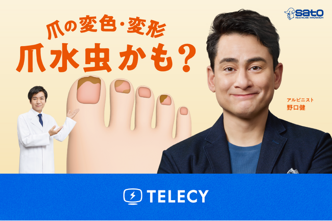 テレシー、佐藤製薬の爪水虫の疾患啓発を目的としたテレビCMの制作・放映を担当
