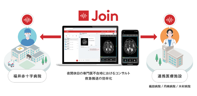 福井県初！Joinによる急性期医療連携を開始