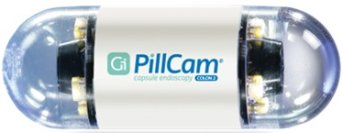 大腸カプセル内視鏡の有効性・安全性・受容性に関する全国多施設共同前向き研究の解析結果