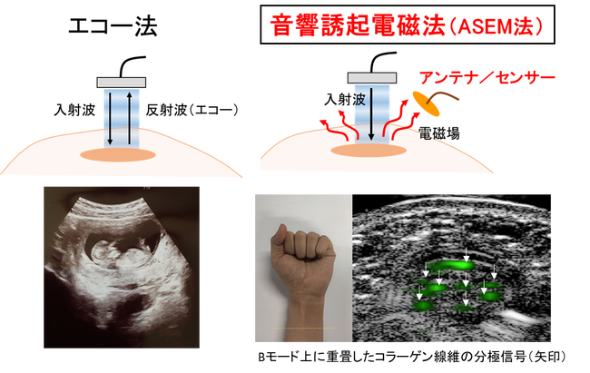 新技術ASEM法による超音波画像化の革新。線維の配向度を精密に評価可能とする技術を解説