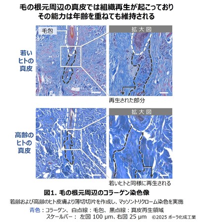 毛の根元でおこる真皮再生に着想し、真皮再生の鍵因子プレイオトロフィンを発見