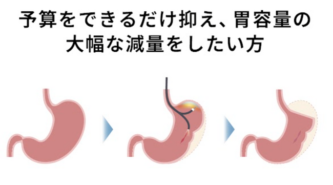 国内でも希少な「SAFE術式」を導入──切らずに痩せる、新時代の減量治療を東京たかはしクリニック練馬院が提供開始