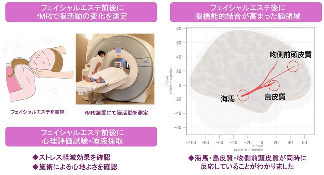 心地よいフェイシャルエステに関連する脳の活動領域を解明