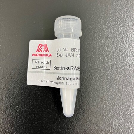Biotin-sRAGE, Human, Recombinant　2025年５月　新発売！