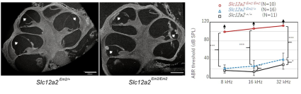 難聴の原因遺伝子SLC12A2の動物モデル開発とその病態解明－きこえない世界を減らすために－（北里大学）