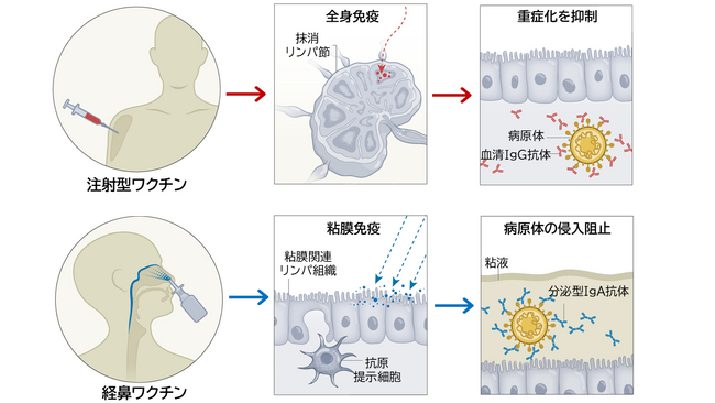 鼻から投与する「経鼻ワクチン」、感染予防の新たな切り札に～千葉大学とUCSDが最新動向を総まとめ