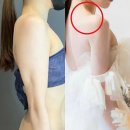 肩周りをスッキリさせたい全ての方へ