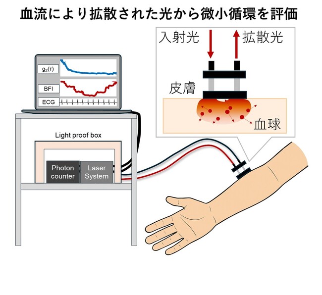光学的血流計測による出血性ショックの微小循環変化を可視化～早期微小循環不全の診断と治療判断への貢献に期待～