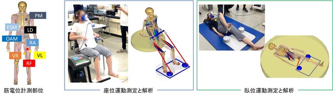 第98回日本整形外科学会学術総会にて、「walkey device」の研究成果を発表
