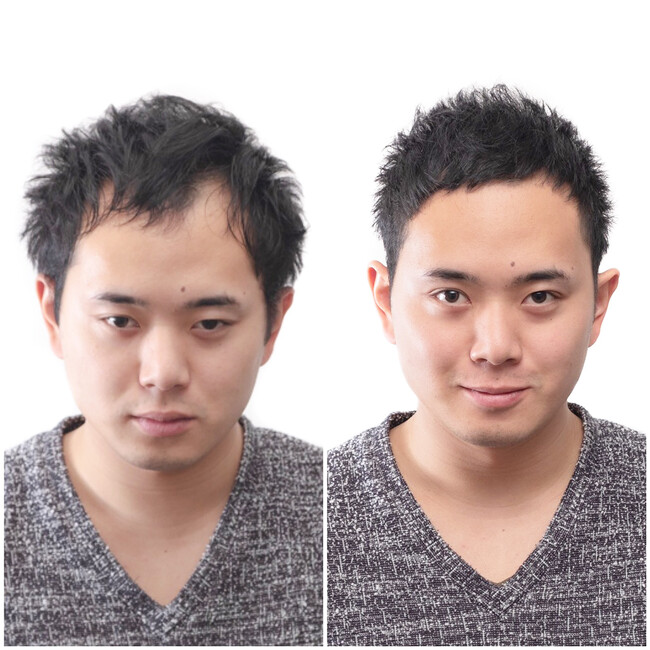 日本初の薄毛男性専門美容院「INTI（インティ）」が東海エリアに初進出！名古屋・池下に2025年7月2日オープン！