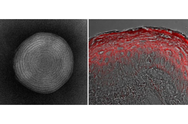 水溶性成分を肌深くまでムラなく浸透させる「高親水性リポソーム」を開発
