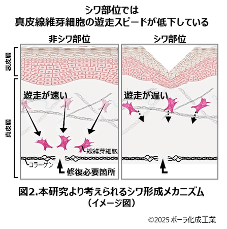 シワ部位では細胞の遊走スピードが低下している可能性を発見
