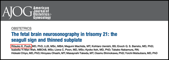 【世界初・AJOG掲載】ダウン症個別化医療の扉を開く胎児脳マーカー発見 - 将来の胎児治療評価にも道筋