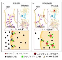 弘前大学の三木康生助教らによる研究グループがレヴィ小体型認知症や多系統萎縮症における認知症の成因を発見