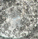 ヒト膵がん患者由来オルガノイドの増殖試験(8日後) a) InnoCell(R) プレート Nタイプ/地方独立行政法人大阪府立病院機構大阪国際がんセンター 平塚 徹 チームリーダー ご提供 ヒト膵がん患者由来オルガノイドの増殖試験(8日後) a) InnoCell(R) プレート Nタイプ/地方独立行政法人大阪府立病院機構大阪国際がんセンター 平塚 徹 チームリーダー ご提供