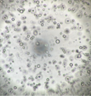 ヒト膵がん患者由来オルガノイドの増殖試験(8日後) b) 既存ポリスチレン製プレート/地方独立行政法人大阪府立病院機構大阪国際がんセンター 平塚 徹 チームリーダー ご提供 ヒト膵がん患者由来オルガノイドの増殖試験(8日後) b) 既存ポリスチレン製プレート/地方独立行政法人大阪府立病院機構大阪国際がんセンター 平塚 徹 チームリーダー ご提供