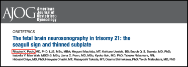 世界初・ダウン症個別化医療の扉を開く胎児脳マーカーを発見　産婦人科学分野の最高峰ジャーナルAJOGに掲載