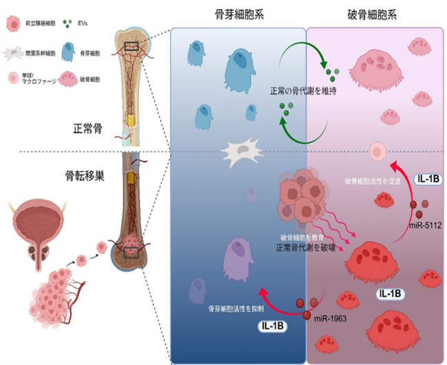 前立腺がんの骨転移を悪化させる仕組みを解明 ～破骨細胞からの“メッセージ”が鍵に～