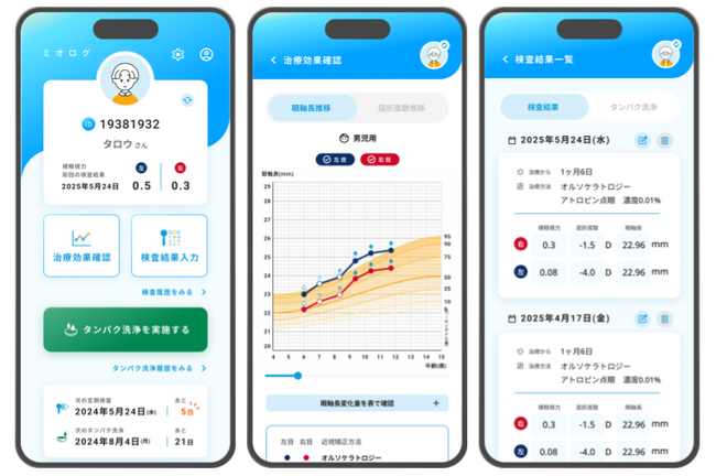 【子会社リリース情報】メニコン社が運営する目の健康を支える近視管理アプリ「ミオログ」の開発事例のご紹介