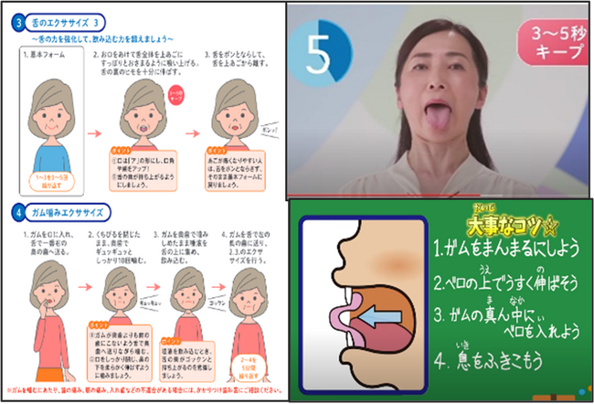 ロッテの「噛むこと」の知見を生かした口腔ケアサービスのプロジェクトを始動