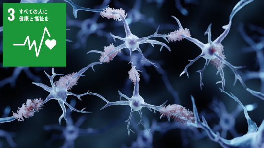 難病「アミロイドーシス」に“光”を。―アミロイドの無毒化による治療効果を初めて実証