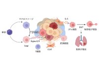 【昭和医科大学・筑波大学】乳がん転移を導く「がん細胞-免疫細胞間シグナル」を解明