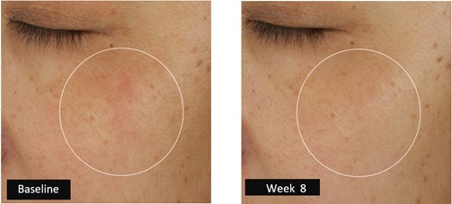 睡眠の日に寄せて ― エスティ ローダー、初の「睡眠不足者」のみを対象としたスキンケア臨床試験結果を発表。