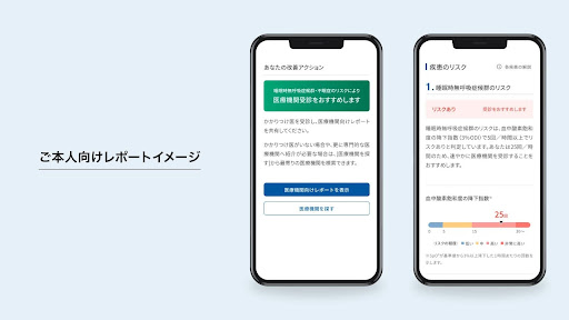 睡眠健康度測定サービス「SLEEP COMPASS」に新たに“睡眠時無呼吸症候群スクリーニング”を追加