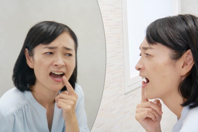 歯の黄ばみとりってどうすればいい?黄ばみの原因や対策について解説!