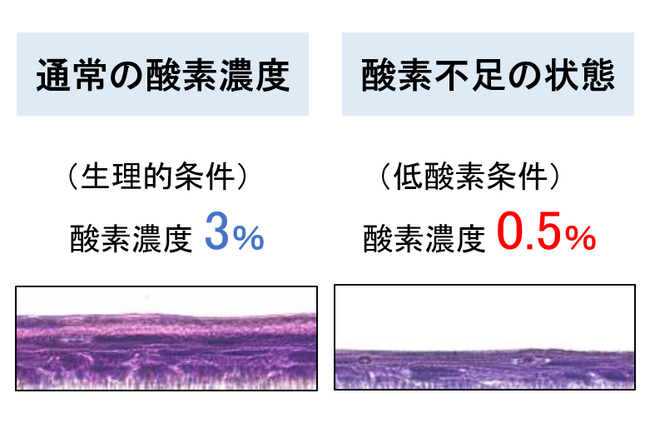 肌が薄くなるのは酸素不足？ ～皮膚の低酸素状態が幹細胞に与える影響を解明～