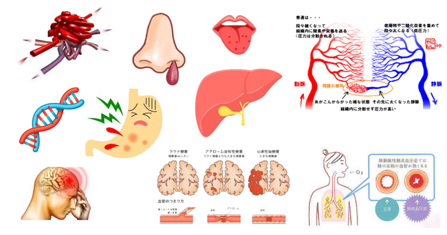 日本オスラー病患者会、医学生・看護学校生を対象とした希少難病227：「オスラー病（HHT）」学習講演会を開催― 患者の声と専門医の知見を通じて、未来の医療人材育成に寄与 ―