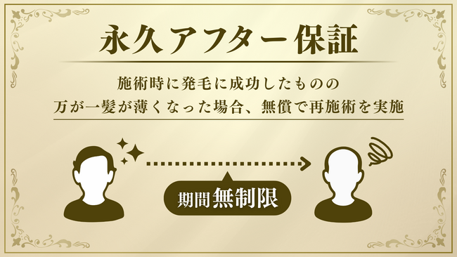 サイゼン毛髪再生総合センター*が『永久アフター保証』を導入