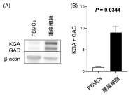 イヌの消化器型リンパ腫に対する新たな治療標的を発見　―グルタミン代謝の阻害が腫瘍細胞の増殖を抑制―（北里大学）