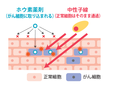 株式会社CICS（リゾートトラスト株式会社の連結子会社）が協力した再発乳がんを対象としたBNCT（ホウ素中性子捕捉療法）の特定臨床研究終了のお知らせ