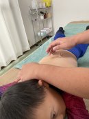 お灸セルフケアの様子