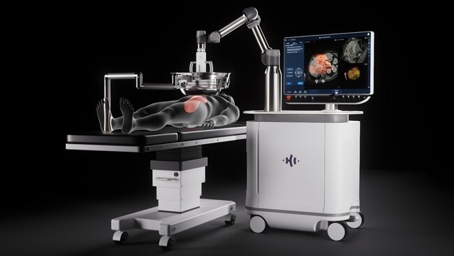 【医療機器「ヒストトリプシープラットフォーム」に関する独占的売買契約を締結】超音波マイクロバブルで治療困難な肝腫瘍に、新たな治療選択肢を