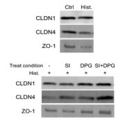 異性化糖とグリチルリチン酸ジカリウムの併用により、敏感肌の不快な症状を緩和するメカニズムを解明