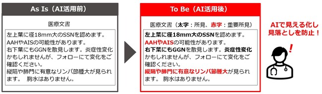 インテック、岩手医科大学と共同で医療文書の見落とし防止に向けたAIの有効性を実証