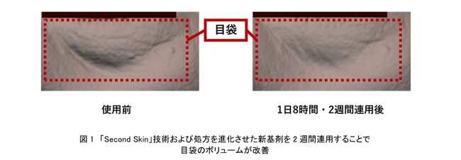資生堂、進化した「Second Skin」技術により目袋のボリュームを改善する新基剤を開発　～新たな作用メカニズムも解明、収縮膜による微弱な圧縮刺激が皮ふ内部に作用～