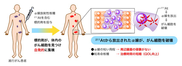 アルファフュージョン、α線核医学治療薬 af-001による分化型甲状腺癌患者を対象とした新規企業主導治験の開始