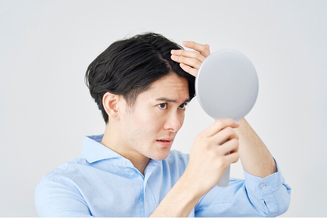 ■【薄毛の悩み最前線 ／ なぜ？ 男性来院者数が前年比「1.85倍（約２倍）」へ増加の理由】 若年層中心に「なって“治療”」から「なる前に“予防”」へ男性意識がシフト、ピーク時は「月間１万人」を突破
