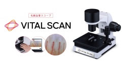 ⾎⾏に着⽬した健康意識向上の取り組み⽑細⾎管スコープ「VITAL SCAN（バイタルスキャン）」販売開始