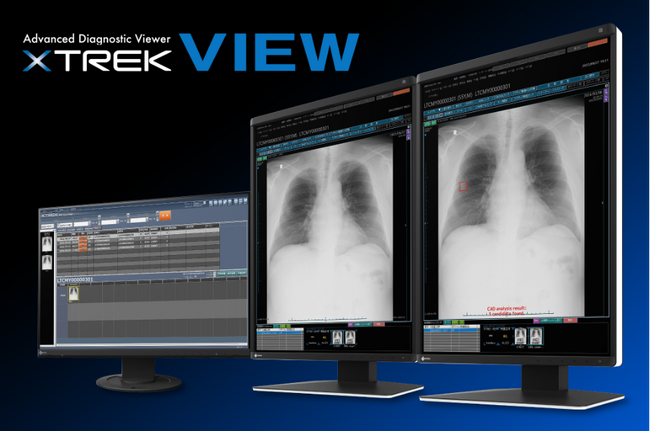 エルピクセル、　ジェイマックシステムとPACS連携・販売連携で画像診断支援AIの普及を推進