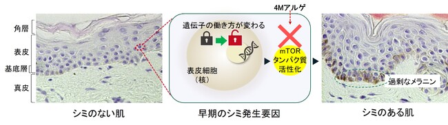 資生堂、早期のシミ発生要因をエピジェネティクス研究で発見　～シミが作られにくい肌質へ導く複合成分 ”4Мアルゲ” を開発～