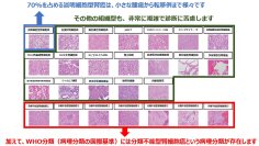 【横浜市立大学】国際標準をめざした腎癌診断支援法を開発