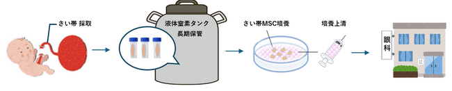 さい帯間葉系細胞由来培養上清を用いた新たな眼疾患治療の開発に関する共同研究契約を締結